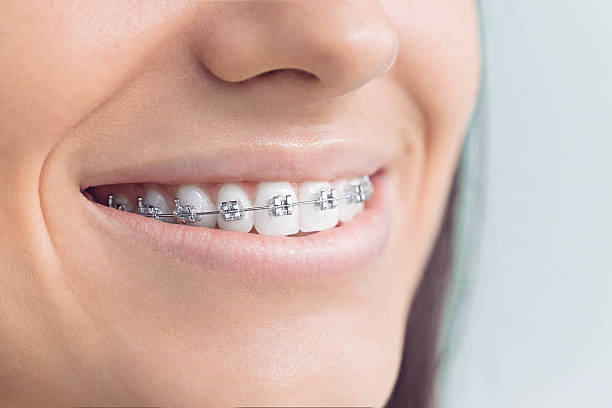 Best Teeth Whitening  in Kiryas Joel, NY